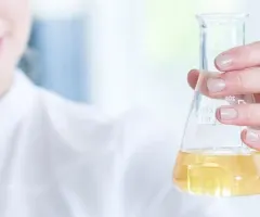 Bayer: Möglicher Durchbruch im Glyphosat-Rechtsstreit – Gerinnungshemmer Asundexian verspricht Milliarden-Umsatzpotential!