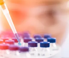 Qiagen: KI-Kooperationen und Digital-PCR wecken Übernahmeinteresse