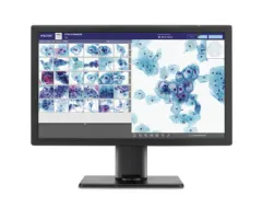 Hologic Announces European Launch of Genius&#8482; Digital Diagnostics System for Cervical Cancer Screening