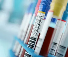 Impfstoff: Warum die Novavax-Aktie über 22 % steigt und die Biontech-Aktie und Moderna-Aktie nicht!