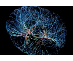 Sprint Zertifikate mit Cap auf ausgewählte KI-Aktien