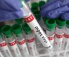 Roche-Chef - Wahrscheinlich mehr Mpox-Fälle in Europa als berichtet